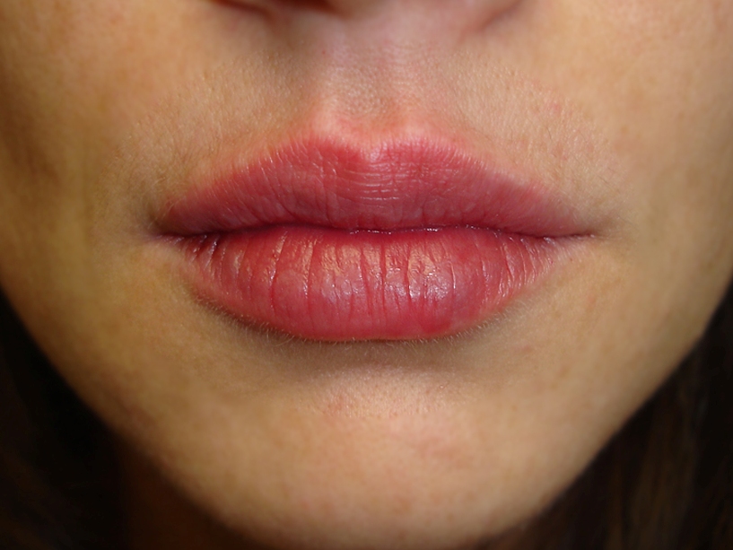 lip juve post